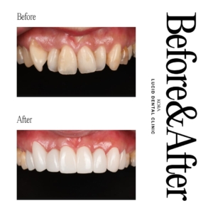 lucid dental clinic_Orthodontic treatment