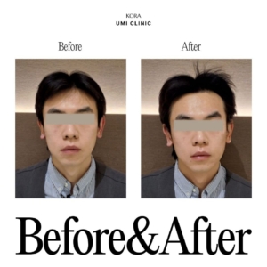 Dr. Jong Woo Yoon_Collagen Volume 1