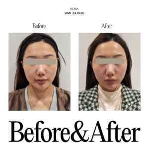Dr. Jong Woo Yoon_Collagen Volume 2